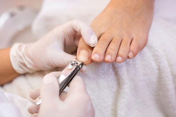 How to Know When Your Toenail Needs Medical Attention